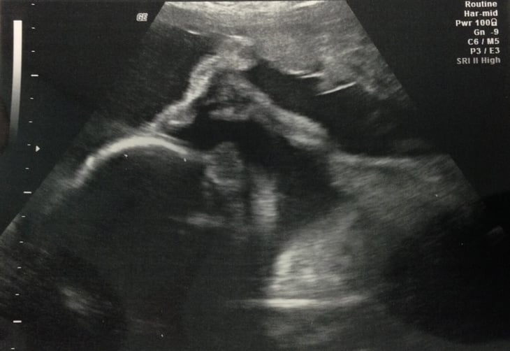 Baby B.jpg